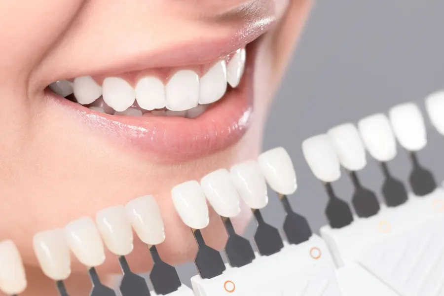 A smile held beside a tooth shade guide